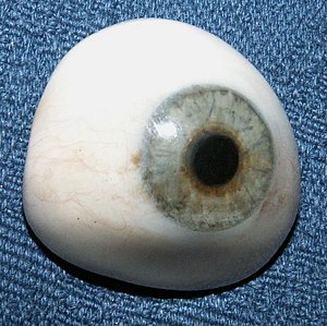 An ocular prosthesis
