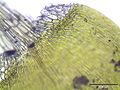 basis of the leaf, magnified 125 times, Photo by Kristian Peters