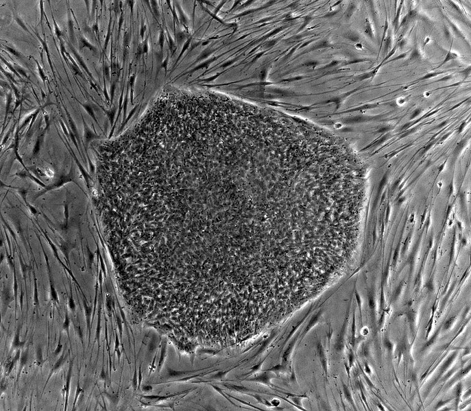 File:Human embryonic stem cell colony phase.jpg
