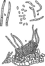 a: Sporodochium van Tubercularia fici