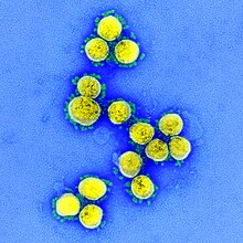 Novel Coronavirus SARS-CoV-2 (49645120251).jpg