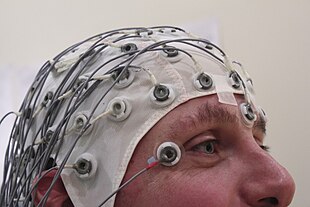 An EEG can aid in locating the focus of the epileptic seizure. EEG Recording Cap.jpg