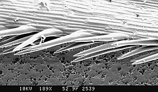 Photomicrographie électronique à balayage de la pointe de l'épillet où l'on voit les micro-barbillons anti-rétrogrades (interdisant toute rétrogression et expliquant le danger de l'épillet).