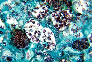 Histoplasmosis capsulatum.jpg