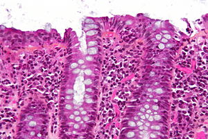 Lymphocytic colitis - hps - very high mag.jpg