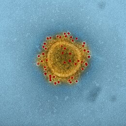 A MERS-CoV koronavírus elektronmikroszkópos képe, NIAID[1]