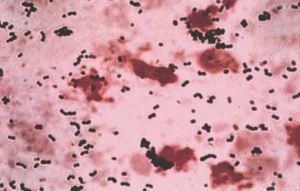 Streptococcus agalactiae.tif