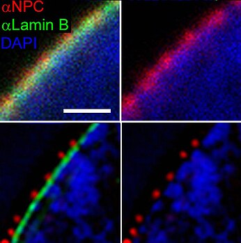 Scanning and illumination microscopy of nuclear pores, lamina, and chromatin. 3D-SIM-1 NPC Confocal vs 3D-SIM detail.jpg