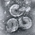 Zwei deutlich Donut- oder Shrimp-förmige Viren in halbseitlich-perspektivischer elektronenmikroskopischen Aufnahme (schwarz-weiß), umgeben von unklarem, granulären Material