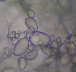Leucoplasts, specifically, amyloplasts Potato - Amyloplasts.jpg