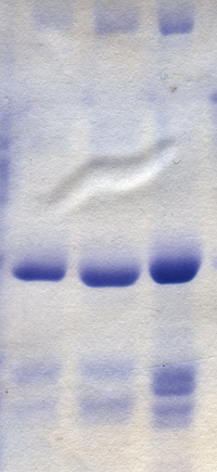 Polyacrylamide gel electrophoresis of rotavirus proteins stained with Coomassie blue Coomassie blue stained gel.png