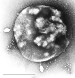 STSV-1 vírussal fertőzött Sulfolobus.