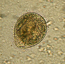 Balantidium coli as seen in a wet mount of a stool specimen. The organism is surrounded by cilia.