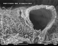 Glomerulus mit gebrochener Kapillare im REM Bildbreite ca. 11,5 µm