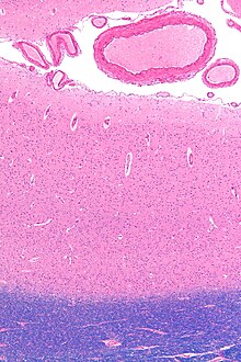 Micrograph showing the visual cortex (pink). The pia mater and arachnoid mater including blood vessels are seen at the top of the image. Subcortical white matter (blue) is seen at the bottom of the image. HE-LFB stain. Visual cortex - low mag.jpg