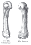 Fifth metacarpal bone (left)