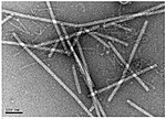 Miniatura per Virus del fruit rugós marró del tomàquet