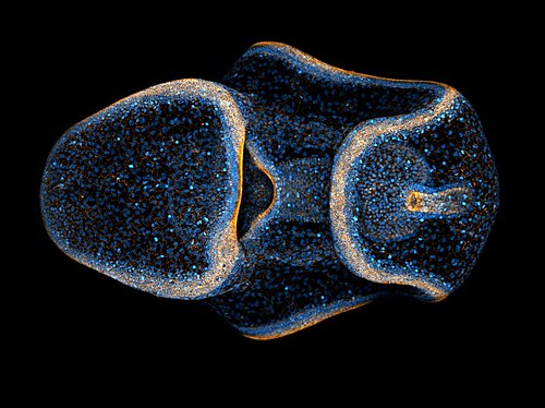 3D projection of a Patiria miniata bipinnaria by Natalie Carrigan. A bat star bipinnaria at fourth day of development photographed using confocal microscopy, with histones labeled in blue and actin filaments in orange. International Runner-Up