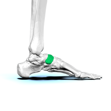 As a metaphor, the navicular bone, shown in green, is known as the keystone of the foot[9]