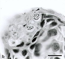 Photo en noir et blanc d'une vue au microscope optique d'une coupe de peau d'un amphibien infecté par le chytridiomycète, montrant deux sporanges contenant des zoospores.