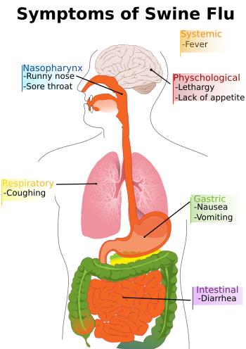 English: Main symptoms of swine influenza. (Se...