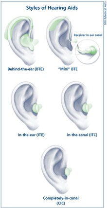 Ear Equalizing Aide