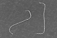 Leptospira interrogans при електронній мікроскопії.