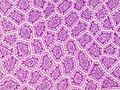 Cross-section histology of intestinal villi of the human terminal ileum.