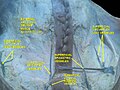 Anterior abdominal wall.Superficial dissection.Anterior view.