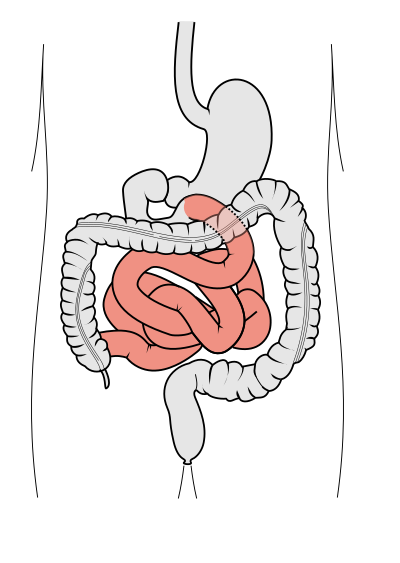 Image:Tractus intestinalis jejunum et ileum.svg