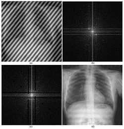 An example of how the 2D Fourier transform can be used to remove unwanted information from an X-ray scan Use of Fourier transformation chest radiography.jpg