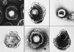 English: Various viruses from the Herpesvirida...