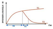 Effects of TR and TE on MR signal TR TE.jpg