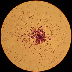 Description de l'image Lactococcus_lactis.jpg.