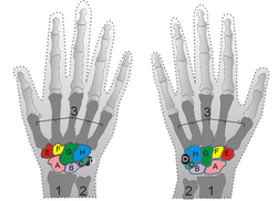 Lunate bone