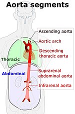 thoracic abdominal aortic aneurysm icd 10