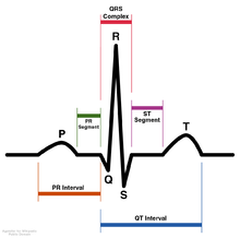 Схематична диаграма на нормалния синусов ритъм за човешко сърце, както се вижда на ЕКГ (с английски етикети)