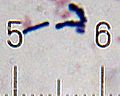 Miniatura para Bifidobacterium animalis