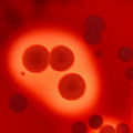 Beta-Hämolyse auf Blutagarplatte