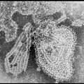 Miniatura para Rubulavirus