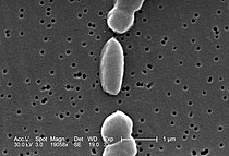 Vibrio parahaemolyticus 01.jpg