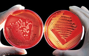 Red blood cells on an agar plate are used to d...