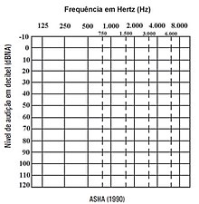 Imagem do audiograma utilizado na avaliação da audiometria