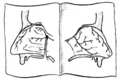 Scheme of the Distribution of the Trigeminal Nerve