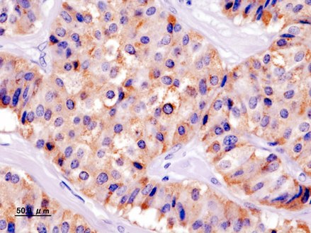 Insulin immuostain