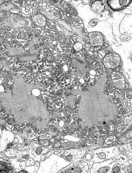 Электронная микрофотография вируса бешенства, на фотографии также видны тельца Бабеша — Негри