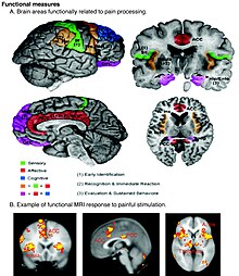 Regions of the cerebral cortex associated with pain Schematic of cortical areas involved with pain processing and fMRI.jpg