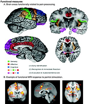 Regions of the cerebral cortex associated with...