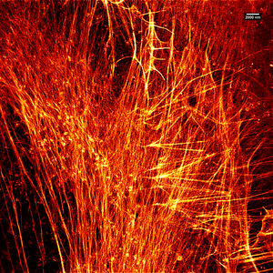 Stimulated emission depletion (STED) microscopy image of actin filaments within a cell MAX 052913 STED Phallloidin.png