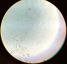 Clostridium acetobutylicum.jpg